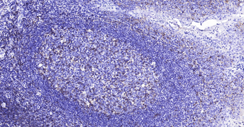 Human CD4 Ready-To-Use IHC Kit