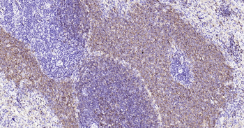 Rat CD20 Ready-To-Use IHC Kit