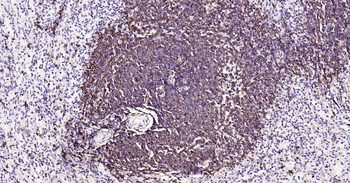 CD20 Ready-To-Use IHC Kit