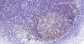 CD20 Ready-To-Use IHC Kit