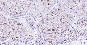 Human PCNA Ready-To-Use IHC Kit