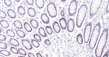 PCNA Ready-To-Use IHC Kit
