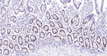 PCNA Ready-To-Use IHC Kit