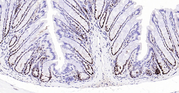 PCNA Ready-To-Use IHC Kit