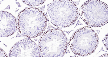 PCNA Ready-To-Use IHC Kit