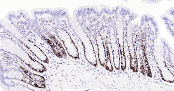 PCNA Ready-To-Use IHC Kit
