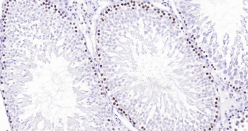 PCNA Ready-To-Use IHC Kit