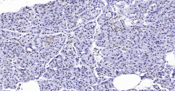 Human GAPDH Ready-To-Use IHC Kit