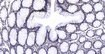 GAPDH Ready-To-Use IHC Kit