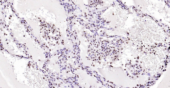 GAPDH Ready-To-Use IHC Kit