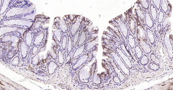 GAPDH Ready-To-Use IHC Kit