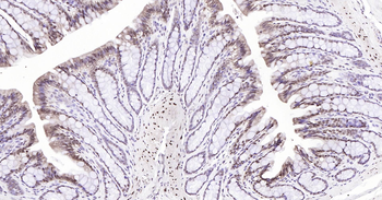 GAPDH Ready-To-Use IHC Kit