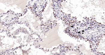 Human Cytochrome C Ready-To-Use IHC Kit