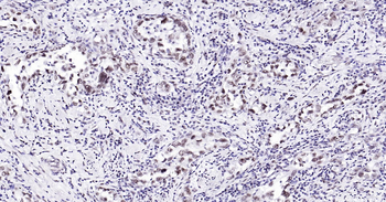 Human HP1 alpha Ready-To-Use IHC Kit