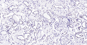 Human HP1 alpha Ready-To-Use IHC Kit
