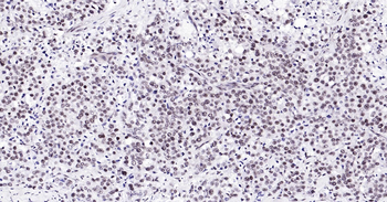 Human HP1 alpha Ready-To-Use IHC Kit