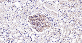 Human CD31 Ready-To-Use IHC Kit