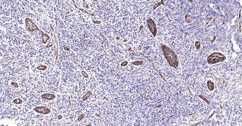 Human CD31 Ready-To-Use IHC Kit