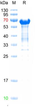 Recombinant human Bcl-6 protein, N-Sumo