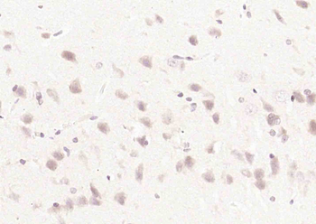 FBXW8 Rabbit Polyclonal Antibody