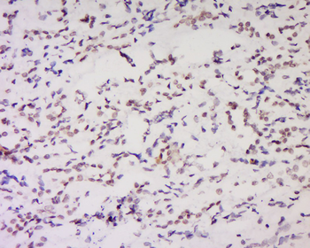 KMT3B Rabbit Polyclonal Antibody