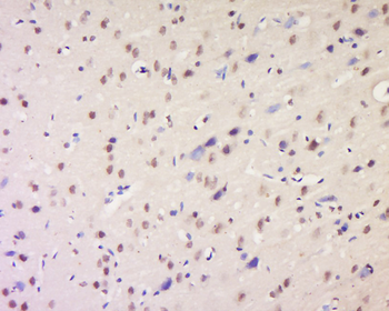 KMT3B Rabbit Polyclonal Antibody