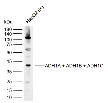 ADH1A + ADH1B + ADH1G Rabbit Polyclonal Antibody