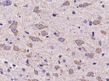AKT2 Rabbit Polyclonal Antibody