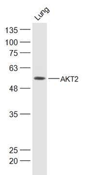 AKT2 Rabbit Polyclonal Antibody