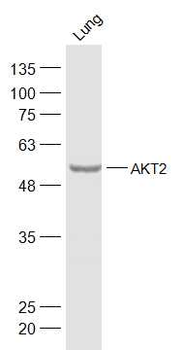 AKT2 Rabbit Polyclonal Antibody