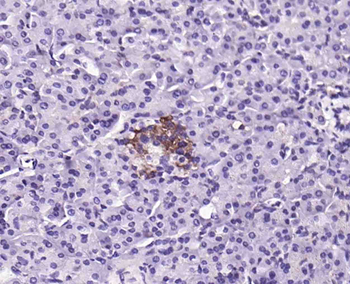 Big dynorphin Rabbit Polyclonal Antibody