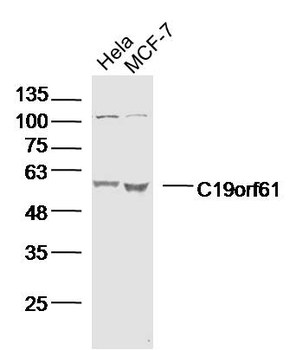 C19orf61 Rabbit Polyclonal Antibody