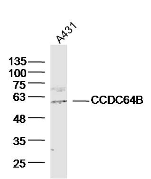 CCDC64B Rabbit Polyclonal Antibody