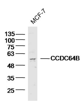 CCDC64B Rabbit Polyclonal Antibody