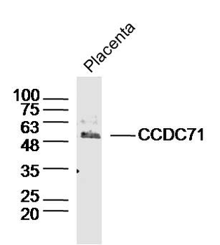 CCDC71 Rabbit Polyclonal Antibody