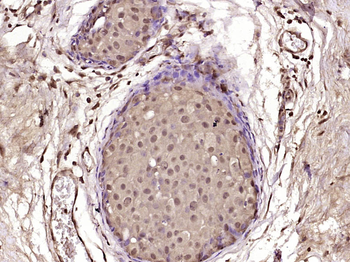 CECR2 Rabbit Polyclonal Antibody