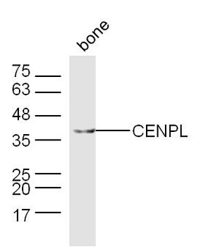 CENPL Rabbit Polyclonal Antibody