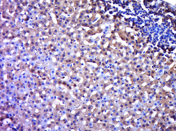 Centaurin alpha 2 Rabbit Polyclonal Antibody
