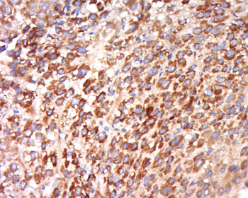 CEP192 Rabbit Polyclonal Antibody