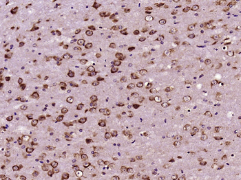 CEP290 Rabbit Polyclonal Antibody