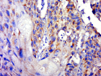 CEP78 Rabbit Polyclonal Antibody