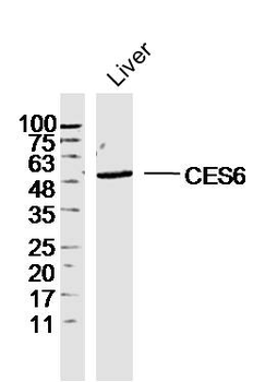 CES6 Rabbit Polyclonal Antibody