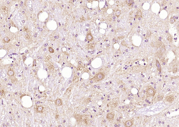 CHERP Rabbit Polyclonal Antibody
