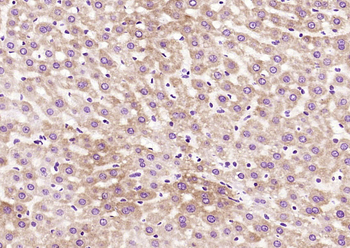CHERP Rabbit Polyclonal Antibody