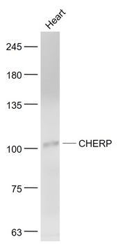 CHERP Rabbit Polyclonal Antibody