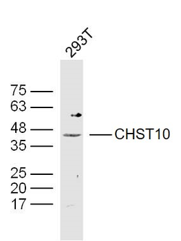 CHST10 Rabbit Polyclonal Antibody