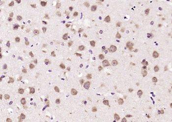 CHST11 Rabbit Polyclonal Antibody