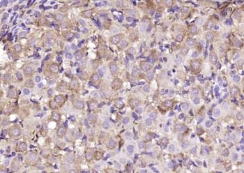 CHST2 Rabbit Polyclonal Antibody
