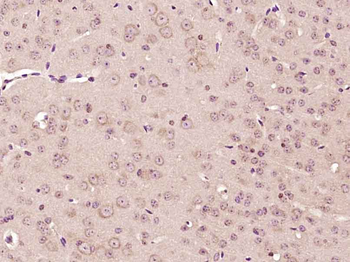 CHST7 Rabbit Polyclonal Antibody