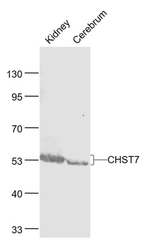 CHST7 Rabbit Polyclonal Antibody